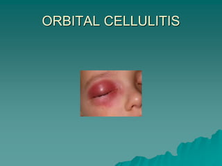 ORBITAL CELLULITIS
 