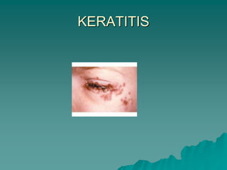 KERATITIS
 