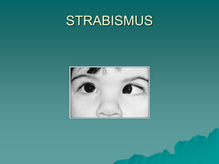 STRABISMUS
 