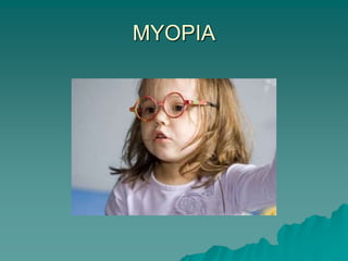 MYOPIA
 