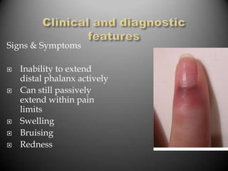 Signs & Symptoms

   Inability to extend
    distal phalanx actively
   Can still passively
    extend within pain
    limits
   Swelling
   Bruising
   Redness
 