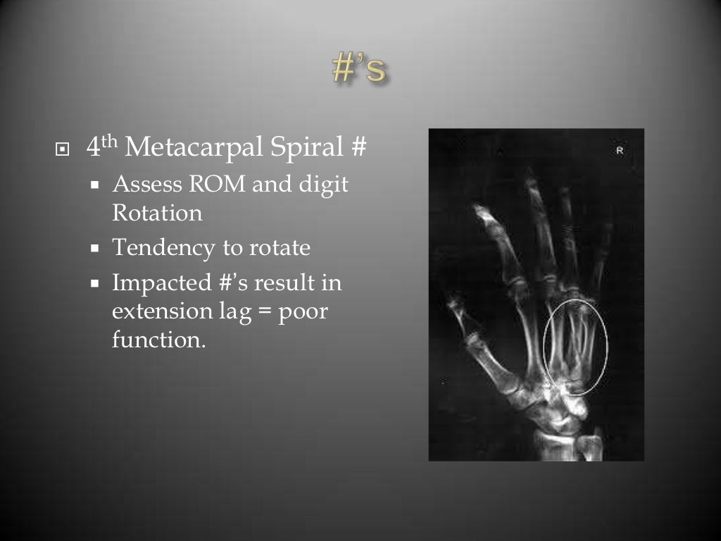 Common hand injuries