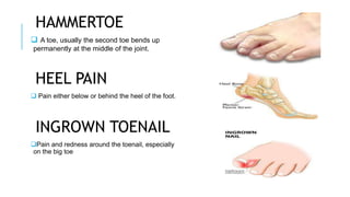 Locking Toes Common health problems in elderly.pptx