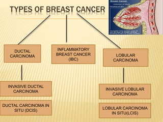 FACTORS THAT CONTRIBUTES TO
BREAST CANCER
1. Gender
2. Age
3. Genetic risk factors
4. Family history
5. Personal history o...