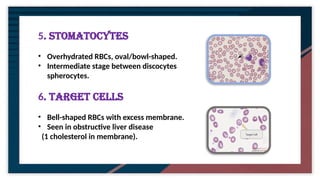 common hematological test (cbc) and its clinical evaluation.pptx