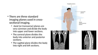 Common Imaging Modalities.pptx uobg somalia | PPTX