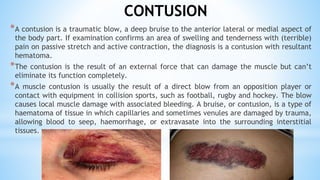 Common Injuries and First Aid with guide | PDF