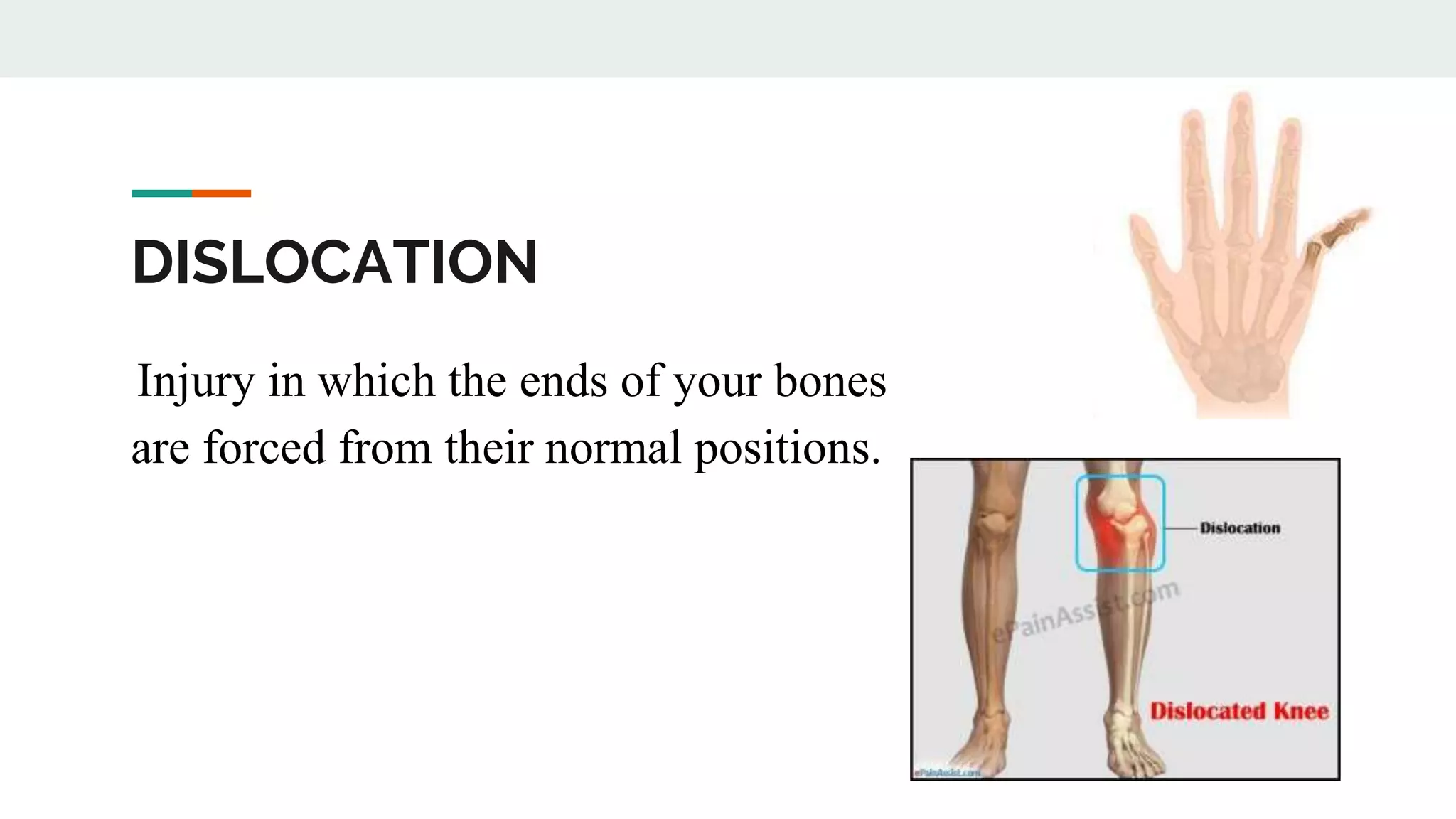 Common Injuries in the Skeletal System | PPTX