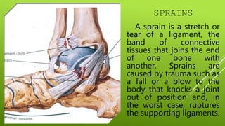 Sprained Definition COMMON INJURIES INVOLVED IN ACTIVE RECREATIONAL ACTIVITIES.pptx