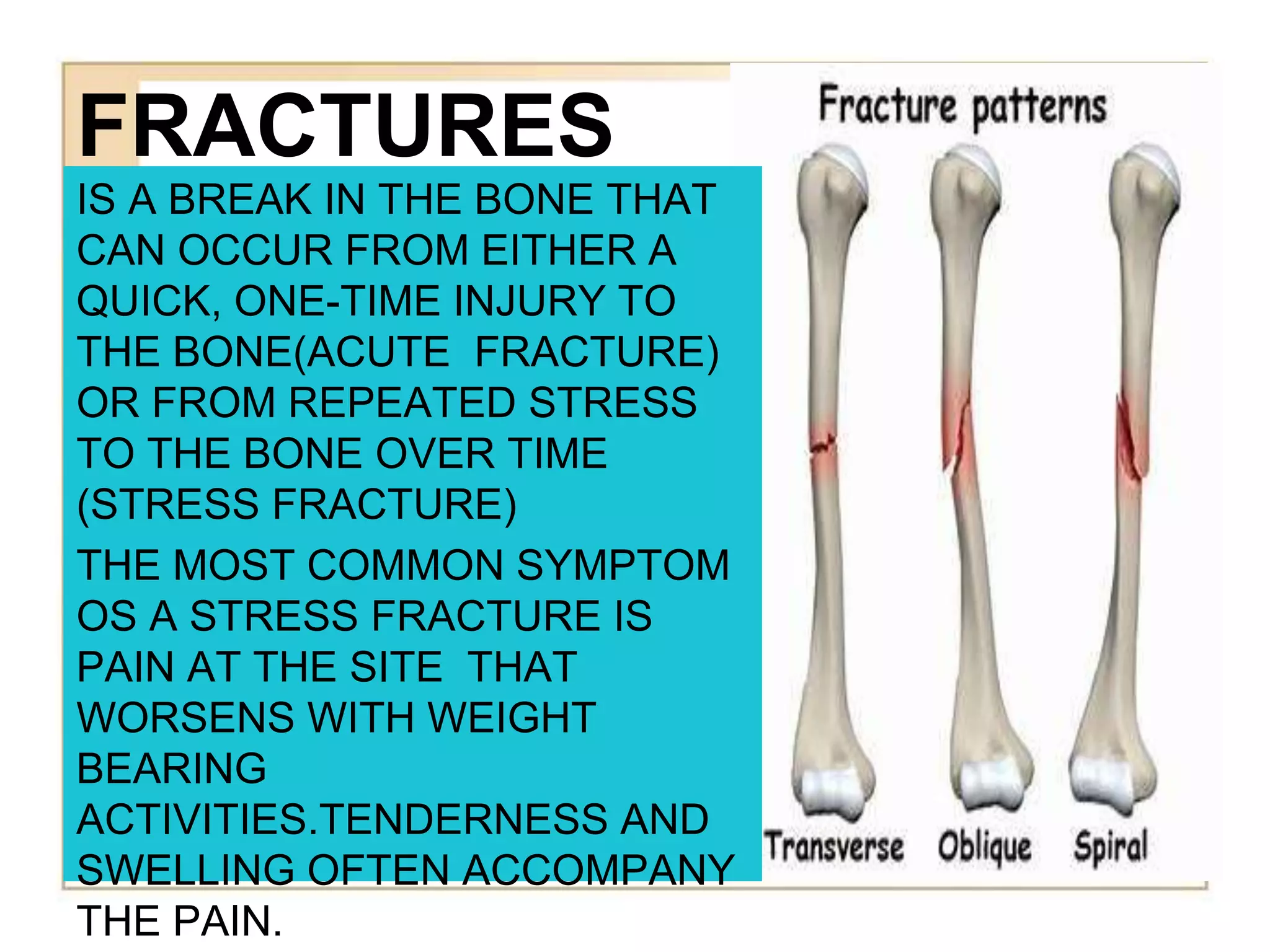 FRACTURES
IS A BREAK IN THE BONE THAT
CAN OCCUR FROM EITHER A
QUICK, ONE-TIME INJURY TO
THE BONE(ACUTE FRACTURE)
OR FROM REPEATED STRESS
TO THE BONE OVER TIME
(STRESS FRACTURE)
THE MOST COMMON SYMPTOM
OS A STRESS FRACTURE IS
PAIN AT THE SITE THAT
WORSENS WITH WEIGHT
BEARING
ACTIVITIES.TENDERNESS AND
SWELLING OFTEN ACCOMPANY
THE PAIN.
 