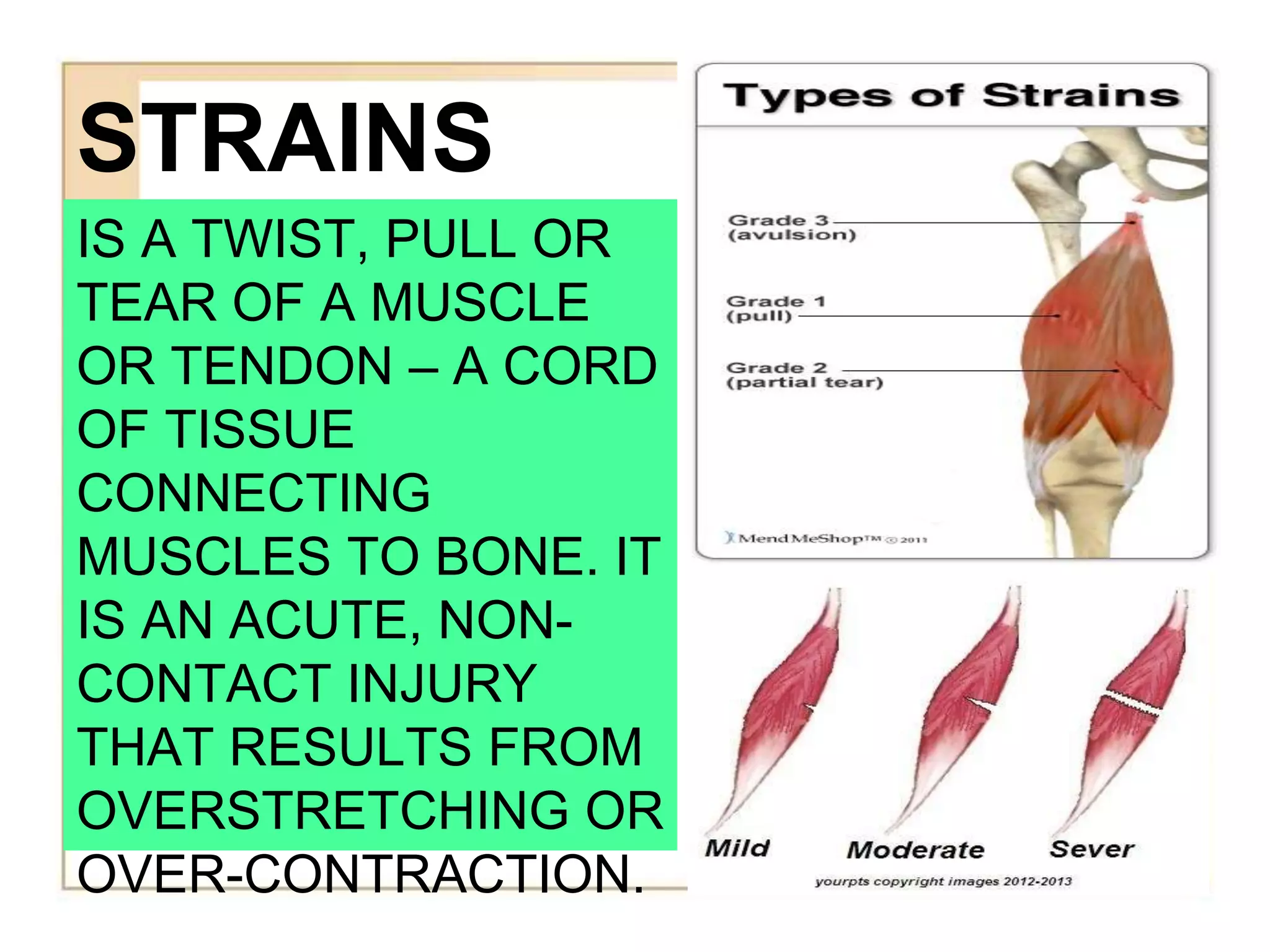 STRAINS
IS A TWIST, PULL OR
TEAR OF A MUSCLE
OR TENDON – A CORD
OF TISSUE
CONNECTING
MUSCLES TO BONE. IT
IS AN ACUTE, NON-
CONTACT INJURY
THAT RESULTS FROM
OVERSTRETCHING OR
OVER-CONTRACTION.
 