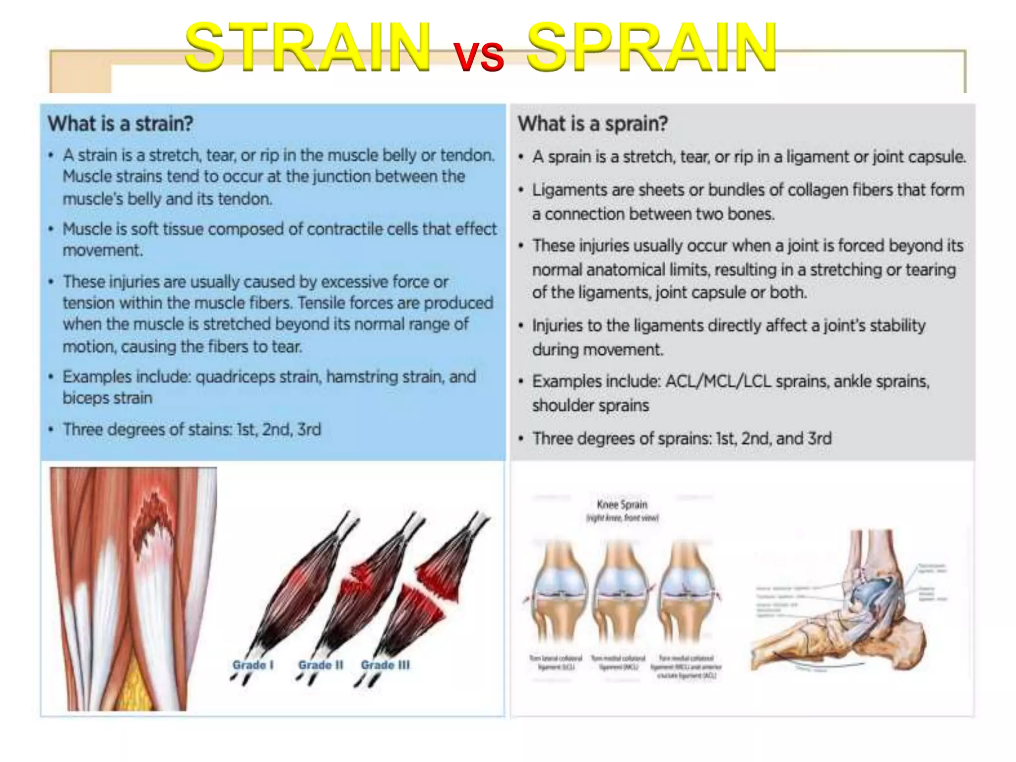 STRAIN VS SPRAIN
 