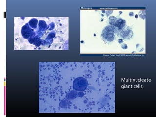 Multinucleated Tissue Common investigations in dermatology | PPT