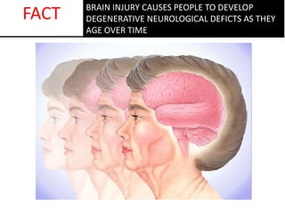 BRAIN INJURY CAUSES PEOPLE TO DEVELOP
DEGENERATIVE NEUROLOGICAL DEFICTS AS THEY
AGE OVER TIME
FACT
 