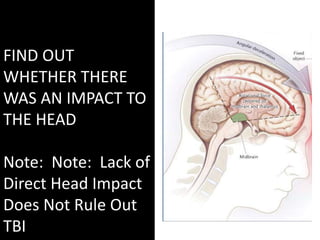 FIND OUT
WHETHER THERE
WAS AN IMPACT TO
THE HEAD
Note: Note: Lack of
Direct Head Impact
Does Not Rule Out
TBI
 