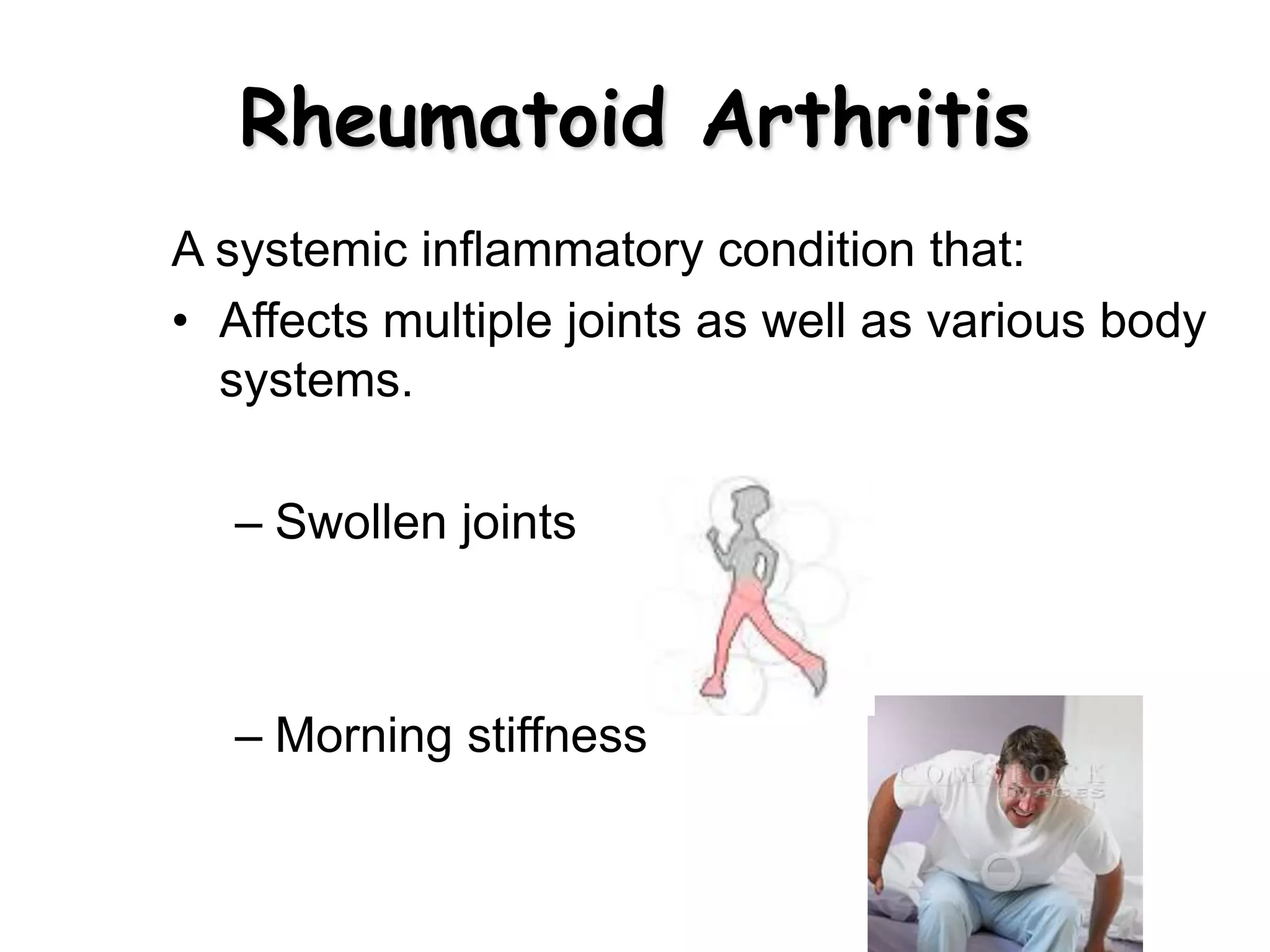 Rheumatoid Arthritis
A systemic inflammatory condition that:
• Affects multiple joints as well as various body
systems.
– Swollen joints
– Morning stiffness
 