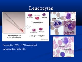 LeucocytesLeucocytes
Neutrophils : 60% (>70%-Abnormal)
Lymphocytes : Upto 40%
 