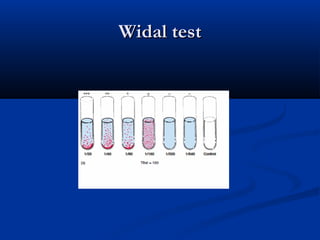 Widal testWidal test
 