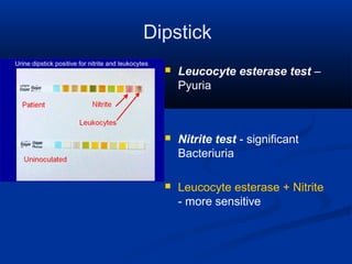 Dipstick
 Leucocyte esterase test –
Pyuria
 Nitrite test - significant
Bacteriuria
 Leucocyte esterase + Nitrite
- more sensitive
 