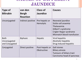 CAUSES OF DIFFERENT
JAUNDICE
 