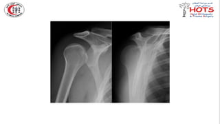 Commonly missed injures in Orthopedic.pptx