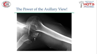 Commonly missed injures in Orthopedic.pptx