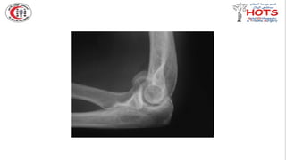 Commonly missed injures in Orthopedic.pptx