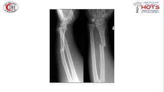 Commonly missed injures in Orthopedic.pptx
