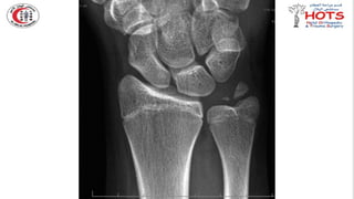 Commonly missed injures in Orthopedic.pptx