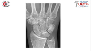 Commonly missed injures in Orthopedic.pptx