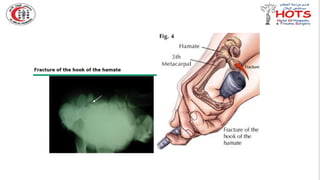 Commonly missed injures in Orthopedic.pptx