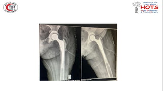 Commonly missed injures in Orthopedic.pptx