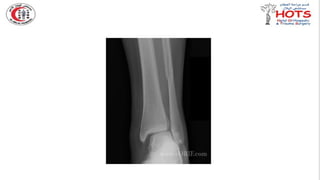 Commonly missed injures in Orthopedic.pptx
