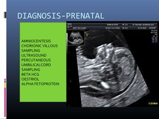 DIAGNOSIS-PRENATAL
AMNIOCENTESIS
CHORIONIC VILLOUS
SAMPLING
ULTRASOUND
PERCUTANEOUS
UMBILICALCORD
SAMPLING
BETA HCG
OESTRIOL
ALPHA FETOPROTEIN
 