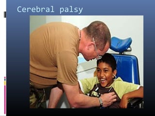 Cerebral palsy
 