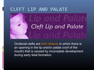 CLEFT LIP AND PALATE
Orofacial clefts are birth defects in which there is
an opening in the lip and/or palate (roof of the
mouth) that is caused by incomplete development
during early fetal formation.
 