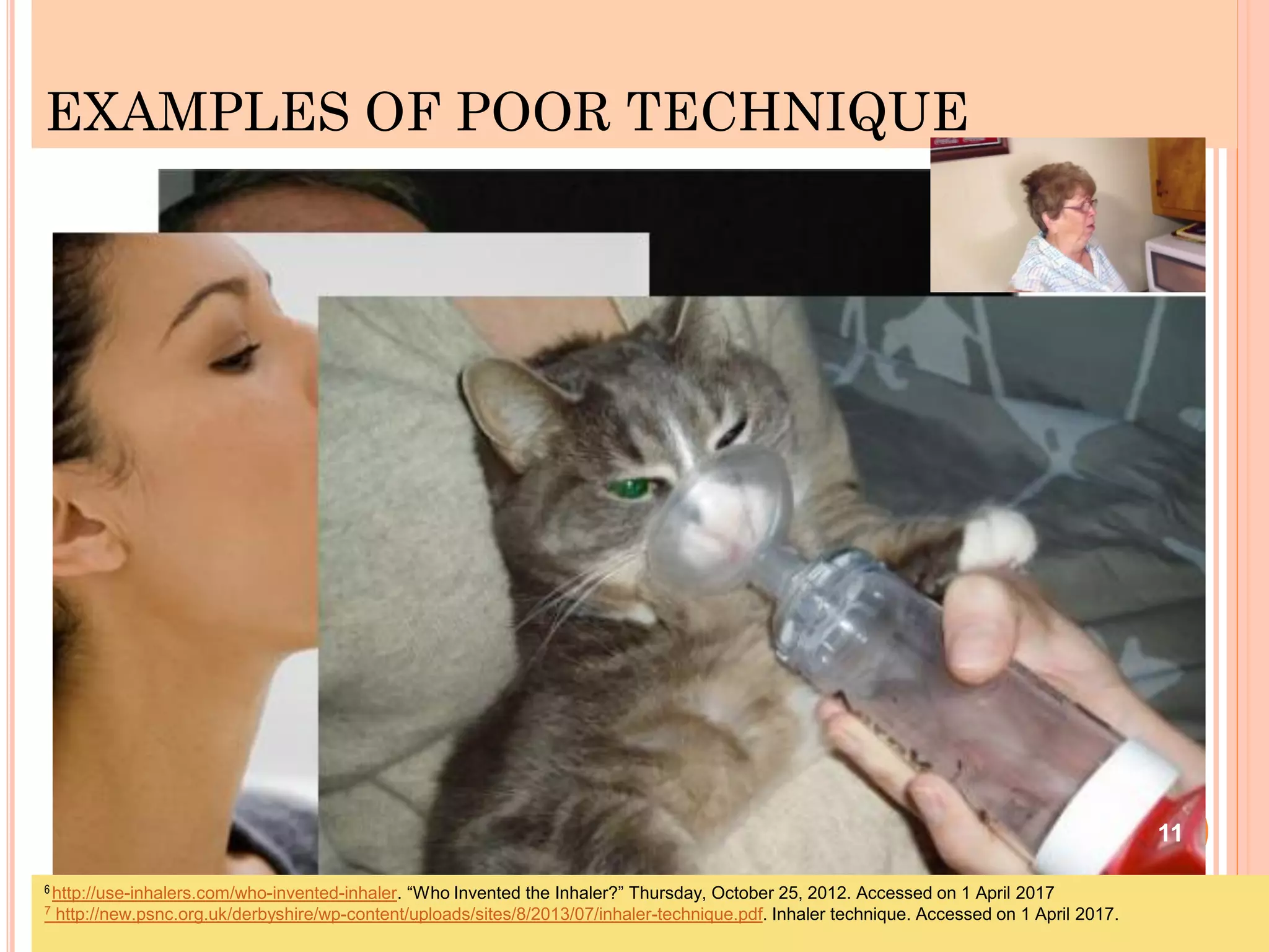 EXAMPLES OF POOR TECHNIQUE
11
6 http://use-inhalers.com/who-invented-inhaler. “Who Invented the Inhaler?” Thursday, October 25, 2012. Accessed on 1 April 2017
7 http://new.psnc.org.uk/derbyshire/wp-content/uploads/sites/8/2013/07/inhaler-technique.pdf. Inhaler technique. Accessed on 1 April 2017.
 