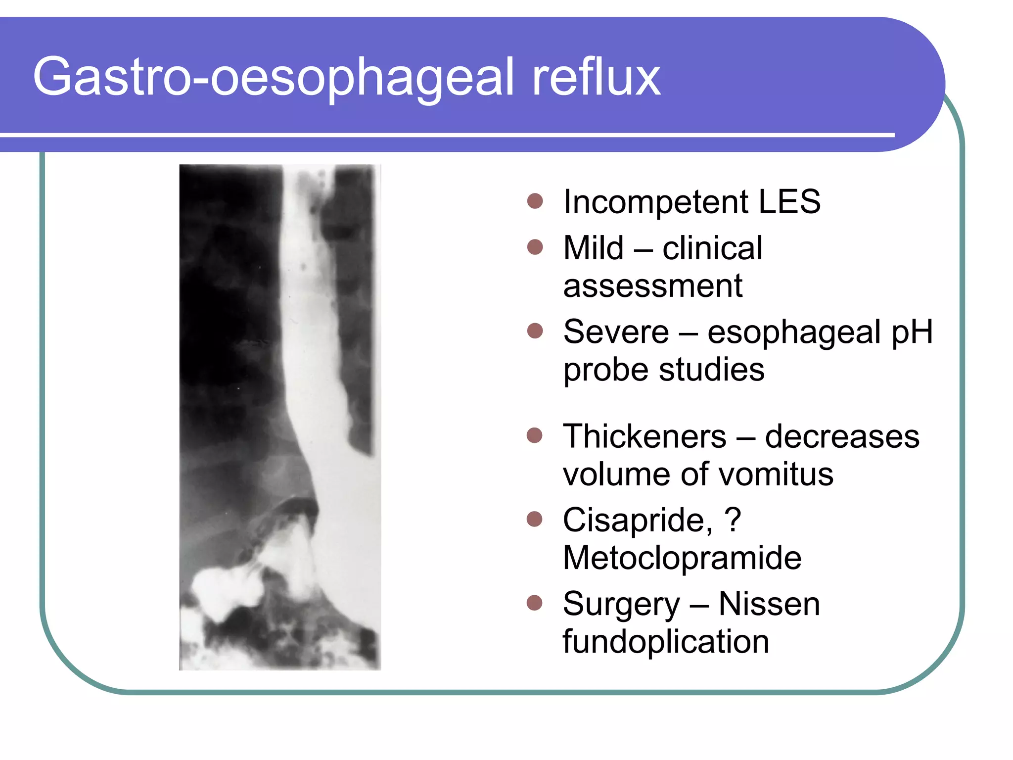 Gastro-oesophageal reflux Incompetent LES Mild – clinical assessment Severe – esophageal pH probe studies Thickeners – decreases volume of vomitus Cisapride, ?Metoclopramide Surgery – Nissen fundoplication 
