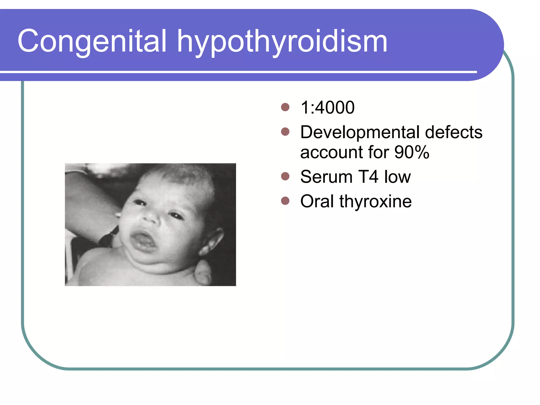 Congenital hypothyroidism 1:4000 Developmental defects account for 90% Serum T4 low Oral thyroxine 