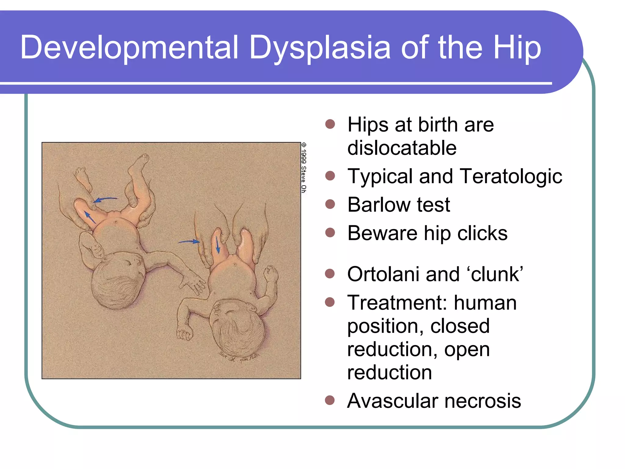 Developmental Dysplasia of the Hip Hips at birth are dislocatable Typical and Teratologic Barlow test Beware hip clicks Ortolani and ‘clunk’ Treatment: human position, closed reduction, open reduction Avascular necrosis 