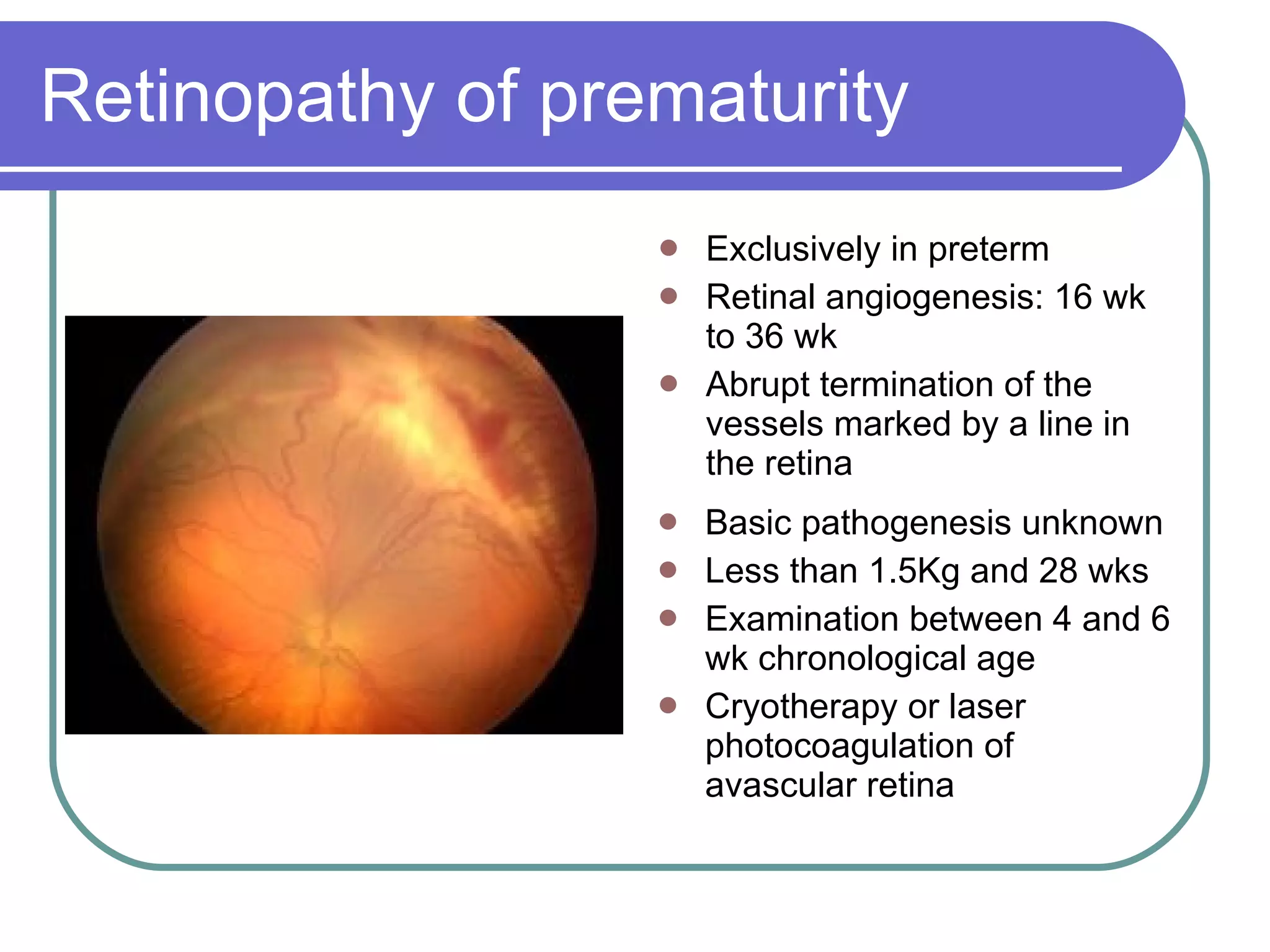 Retinopathy of prematurity Exclusively in preterm Retinal angiogenesis: 16 wk to 36 wk Abrupt termination of the vessels marked by a line in the retina Basic pathogenesis unknown Less than 1.5Kg and 28 wks Examination between 4 and 6 wk chronological age Cryotherapy or laser photocoagulation of avascular retina 