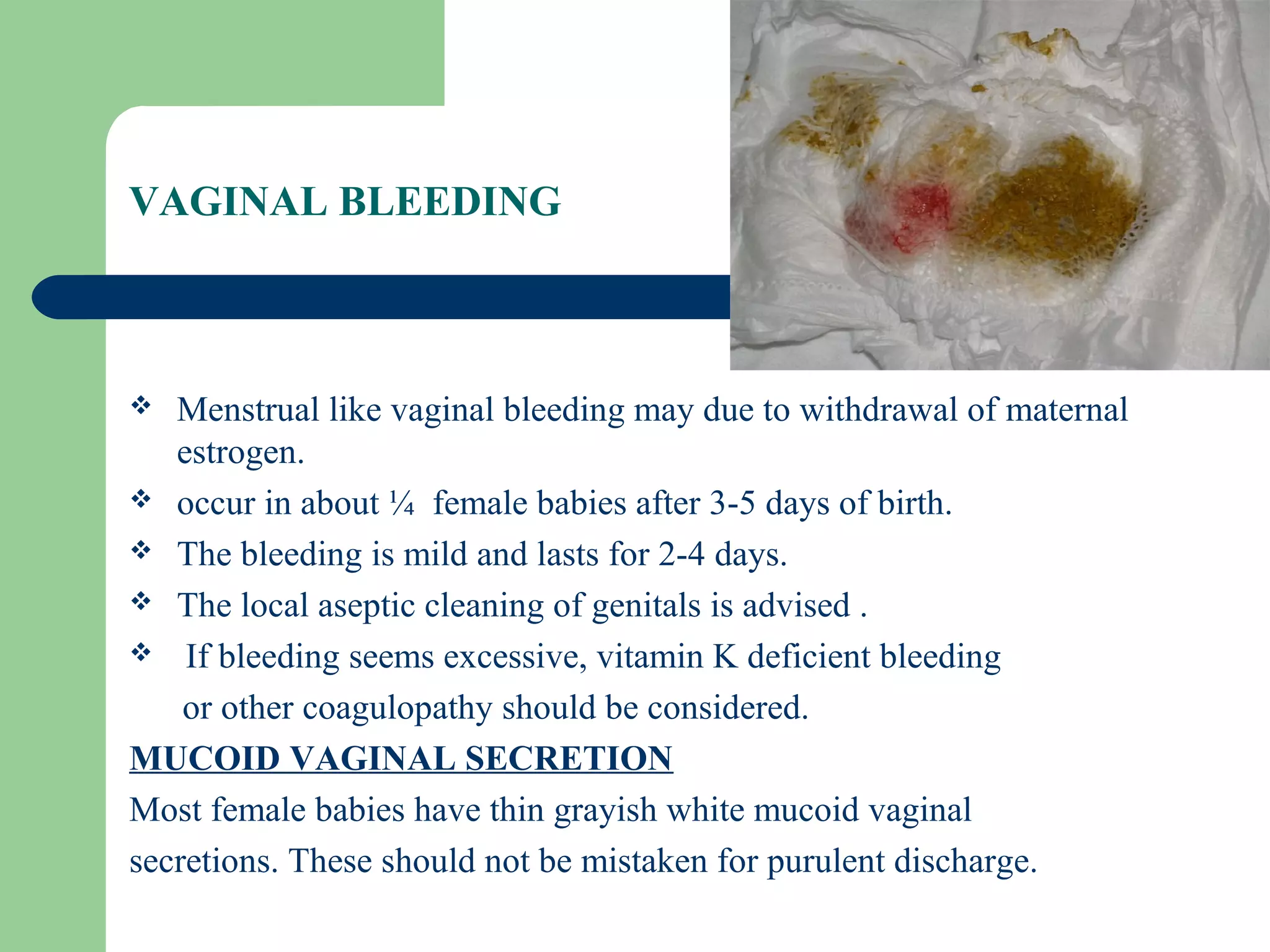 Common neonatal problems | PPT