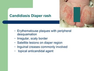 Common neonatal problems | PPT