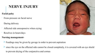 Common neonatal problems [Autosaved].pptx