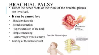 Common neonatal problems [Autosaved].pptx