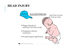 Common neonatal problems [Autosaved].pptx