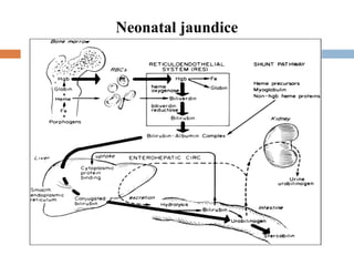 Pathologic Jaundice approach to the diagnosis of Neonatal jaundice | PPT