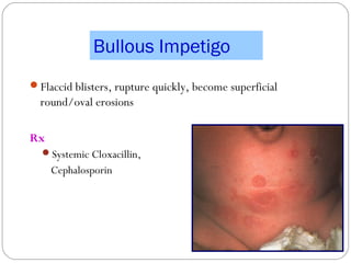 Common neonatal skin problems | PPT