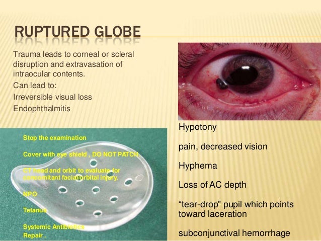 Common ocular emergencies