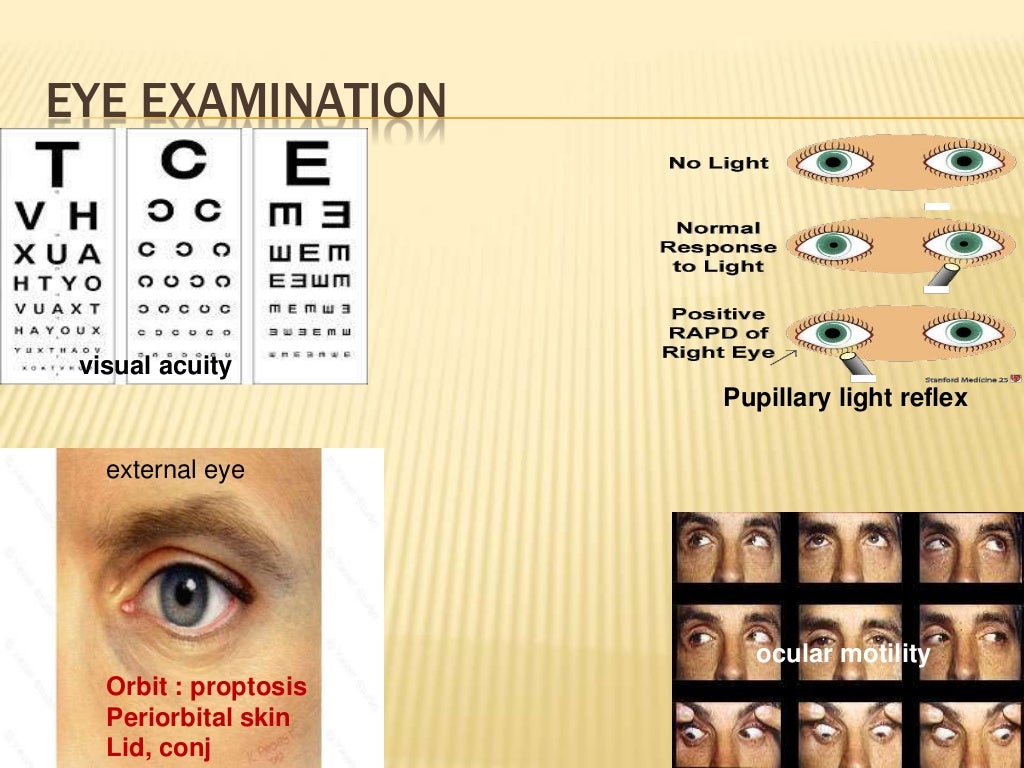Common ocular emergencies